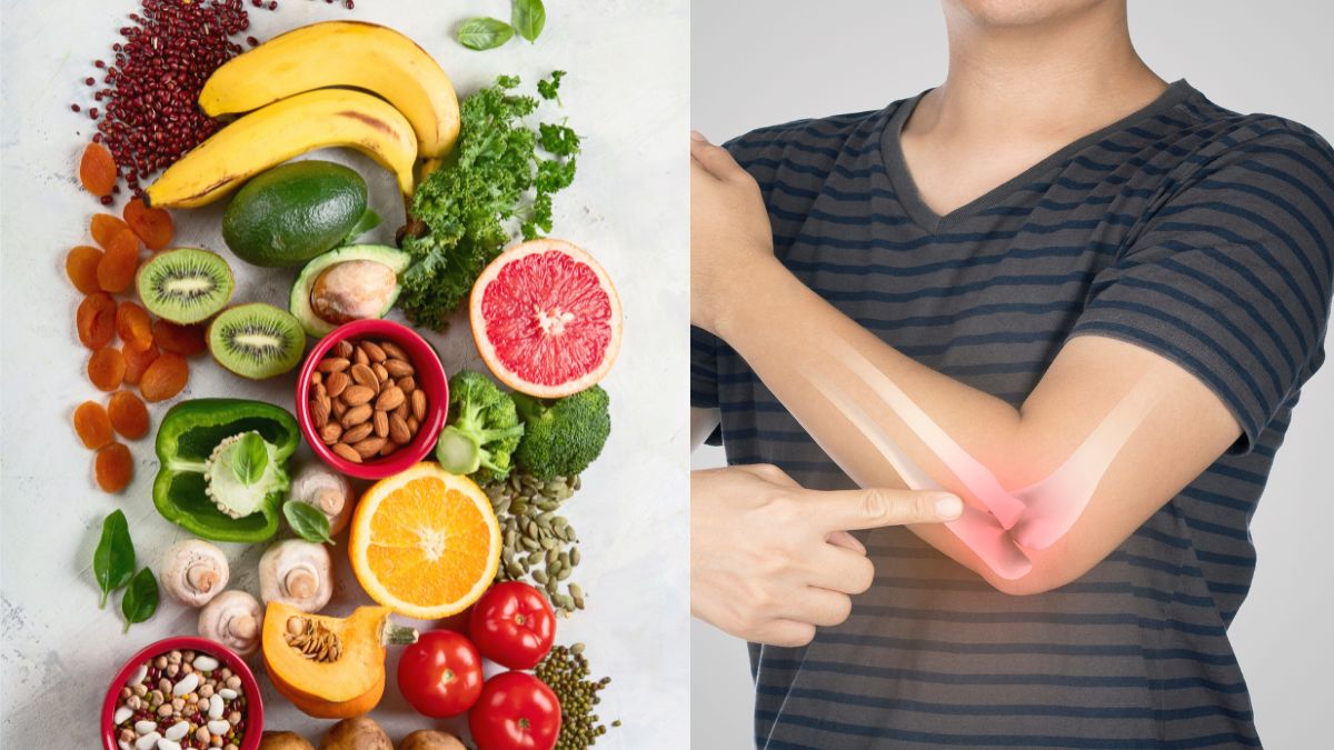 5-healthy-superfoods-to-keep-your-bones-in-check